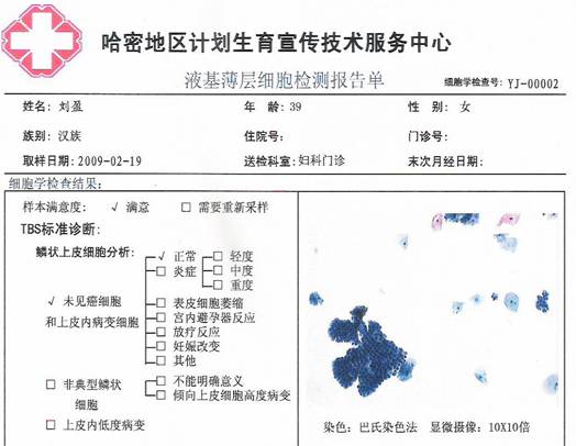 TCT檢測